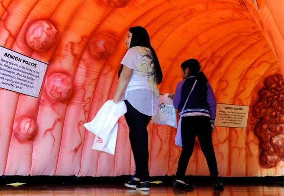 Giant Colon Exhibit